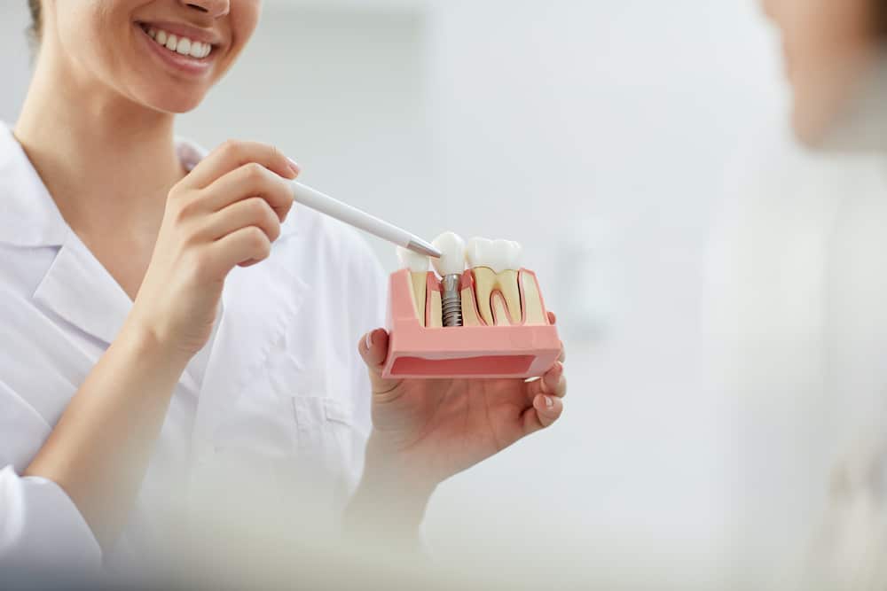 dental implants