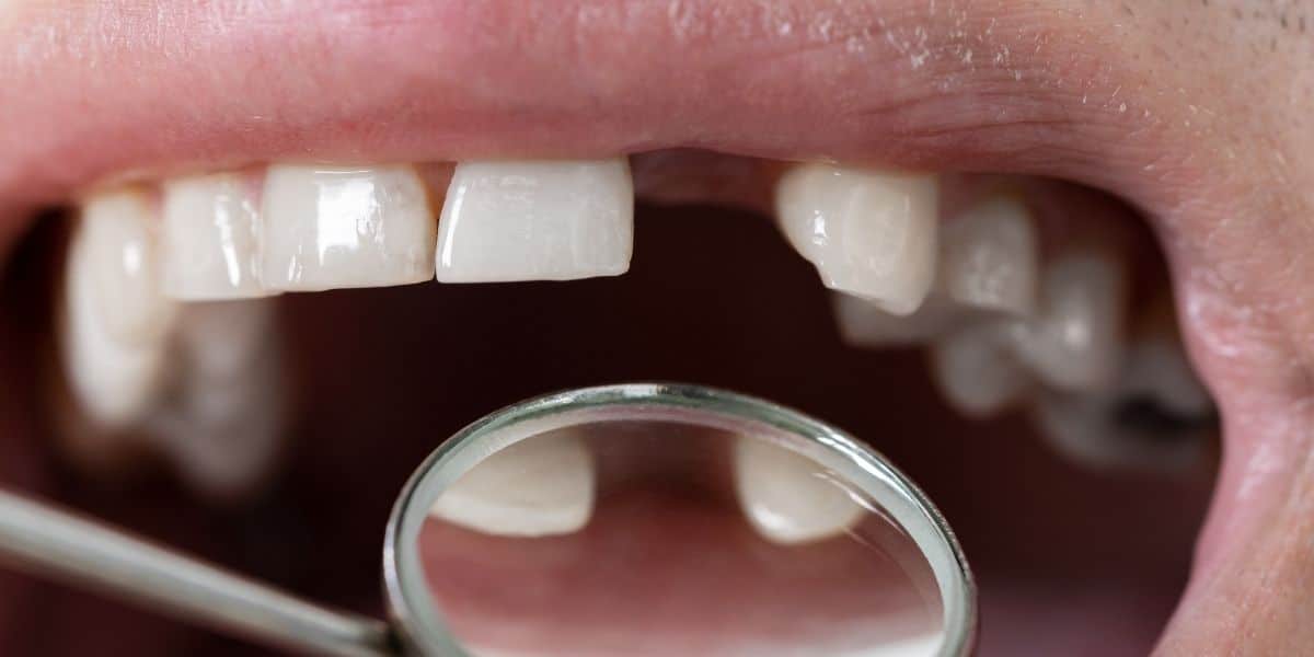 dentist near Lorton, VA