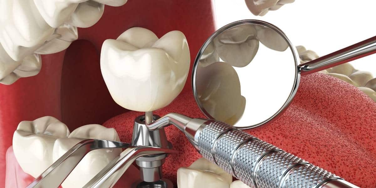 dentist in Lake Ridge, VA